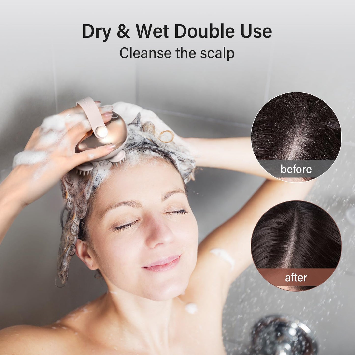 arboleaf Electric Scalp Massager Head Massager Scalp Stress Relax, 5 in 1 Kneading 128 Massage Nodes, Waterproof Hair Massage with 8 Removable Claws Cat Scratcher, Gift for Dad Mom