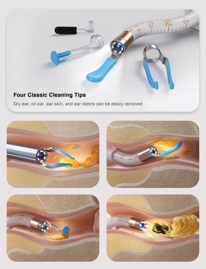 BEBIRD Earsight Plus Ear Wax Removal Tool Camera with HD Visual Otoscope, Smart WiFi Earwax Cleaner Kit, Safe Silicone Flexible Scoops & Tweezers Tools for Adults & Kids (Blue)