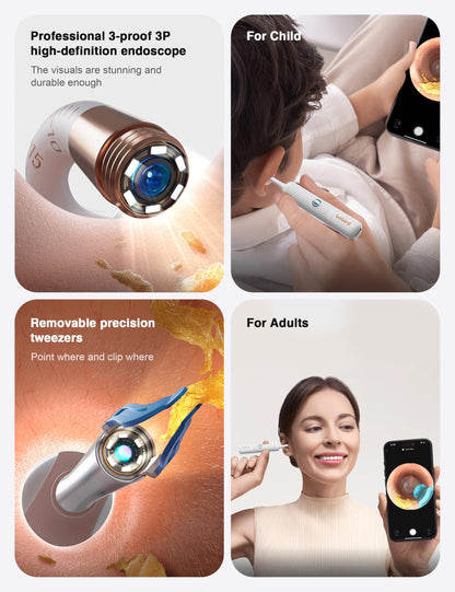 BEBIRD Earsight Plus Ear Wax Removal Tool Camera with HD Visual Otoscope, Smart WiFi Earwax Cleaner Kit, Safe Silicone Flexible Scoops & Tweezers Tools for Adults & Kids (Blue)
