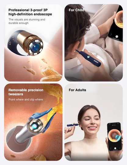BEBIRD Earsight Plus Ear Wax Removal Tool Camera with HD Visual Otoscope, Smart WiFi Earwax Cleaner Kit, Safe Silicone Flexible Scoops & Tweezers Tools for Adults & Kids (Blue)