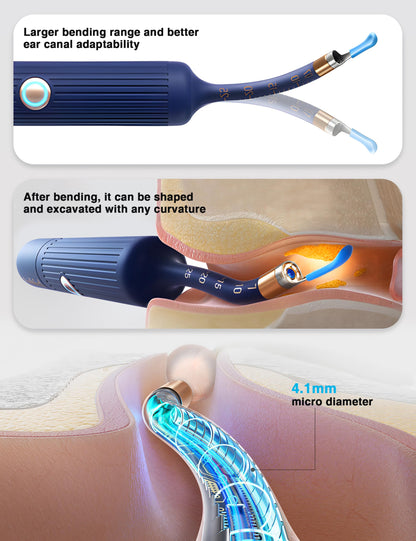 BEBIRD Earsight Plus Ear Wax Removal Tool Camera with HD Visual Otoscope, Smart WiFi Earwax Cleaner Kit, Safe Silicone Flexible Scoops & Tweezers Tools for Adults & Kids (Blue)