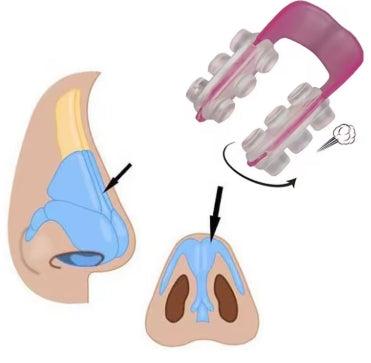 corrector nasal