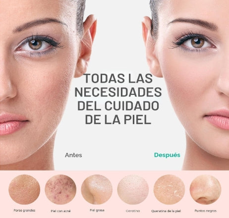 PRITECH SkinWave