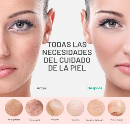 PRITECH SkinWave